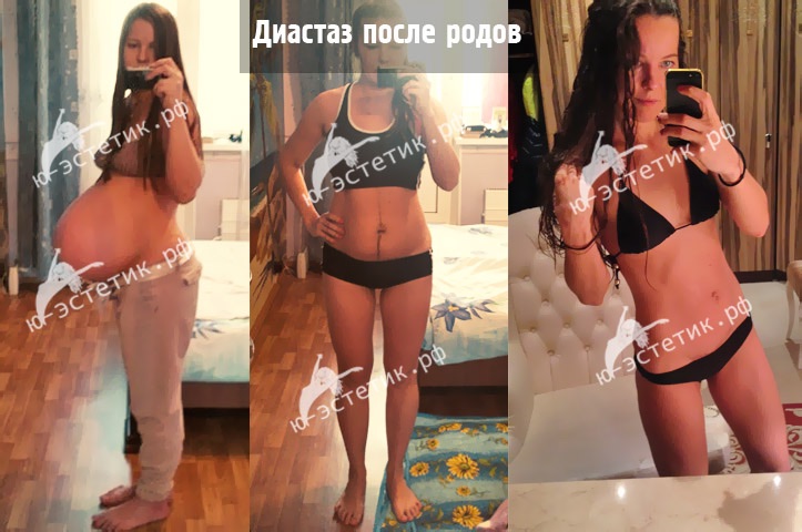 как улучшить запах изо рта как улучшить запах изо рта